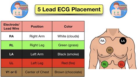 how to place telemetry leads.